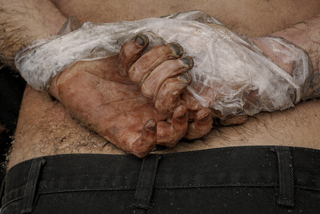 Russia Ukraine War Half A Year Photo Gallery
